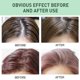 thumbnail image 4 of Spray para el cabello voluminizador y esponjoso con control instantáneo de aceite natural de Jaysuing Hair Care -8080789157654, 4 of 5