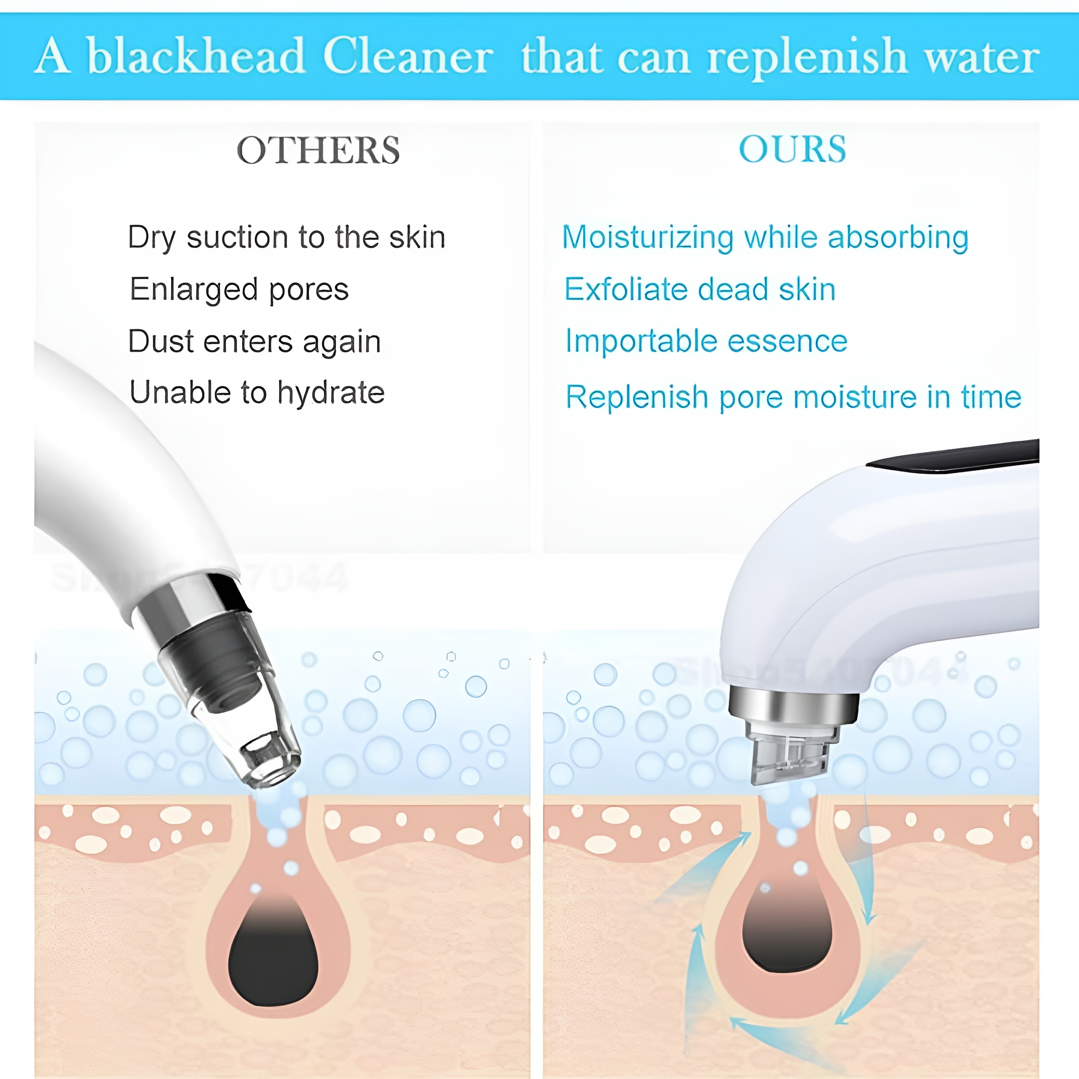 XIRQI Blackhead Remover Pore Vacuum, with 6 Suction Heads Replaceable, Facial Cleaner Beauty Instrument Electric Strong Suction Comedone Extractor Tool for Acne Removal Blackhead Sucker, White