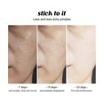 thumbnail image 3 of Jaysuing 1pcs 120g Acne Removal Soap Facial Cleansing Facial Acne Control Body Back Acne Cleansing Handmade Soap |, 3 of 5
