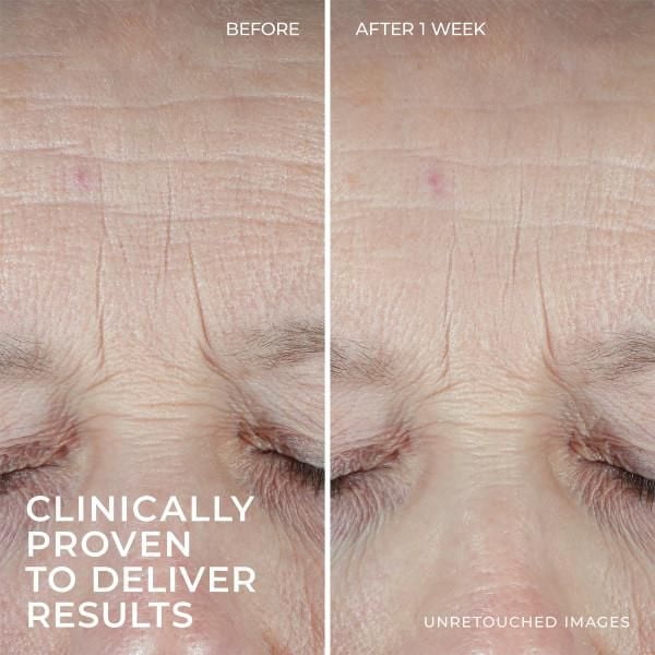 RoC Skincare - Hydratation + Moisturizer®️ - + Acide Hyaluronique + Protéine de Collagène - 48gm RoC Skincare