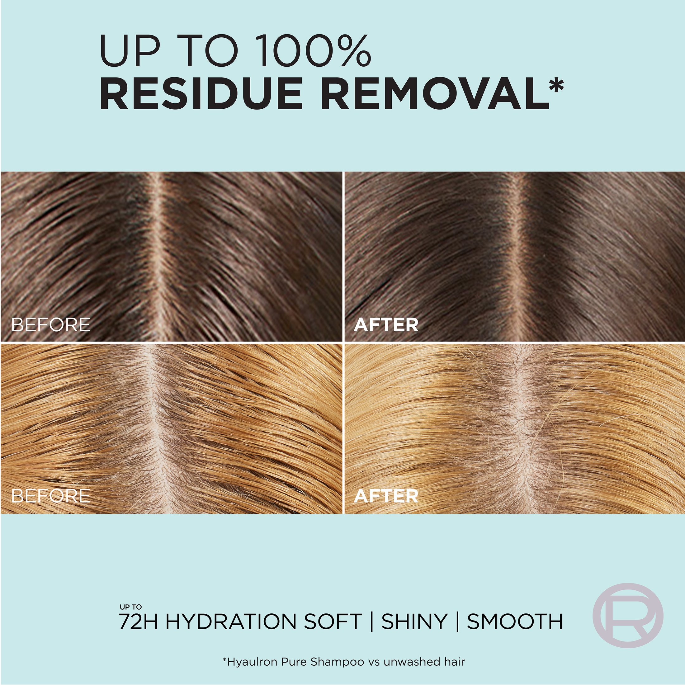 L'Oréal Paris Elvive Hyaluron Pure Oily Hair Set photo 4