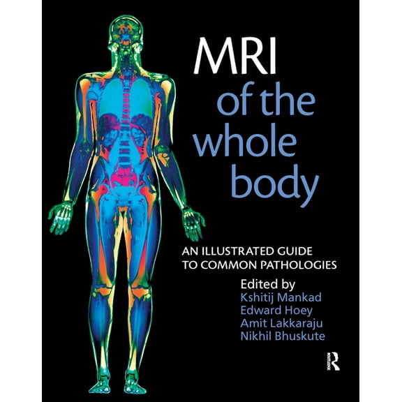 MRI of the Whole Body: An Illustrated Guide for Common Pathologies (Paperback)