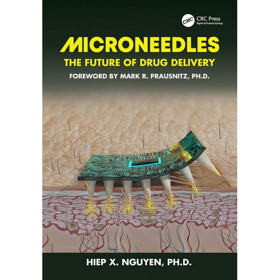 Microneedles: The Future of Drug Delivery, (Paperback)