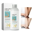 GuLuBin Hair Gadgets Elbow Lotion Lightens Joint Dullness Nourishes and Skin To An Even and