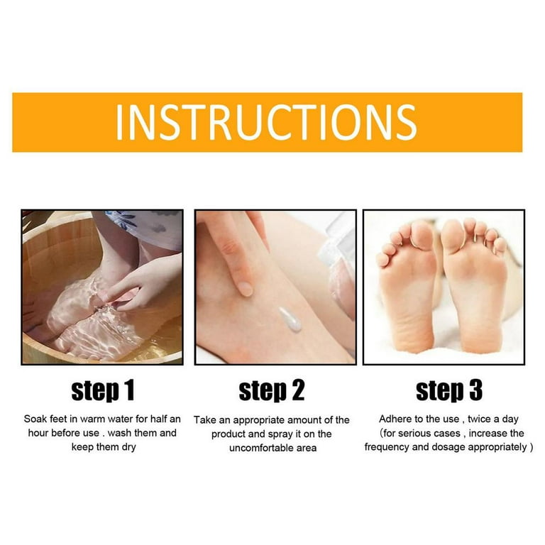 Foot Callus Removal Spray, Foot Peeling Spray That Remove Dead Skin, Feet  Callus Remover, Foot Peeling Spray Orange Oil, Instant Foot Peeling Spray