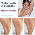 thumbnail image 3 of Braun Silk-Expert Mini IPL1111 Corded IPL Hair Removal Device, At Home Laser Hair Removal for Women and Men with Pouch, Venus Razor, 3 of 17