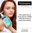 thumbnail image 3 of Neutrogena Evenly Clear Acne Cleanser with Salicylic Acid, 9.1 fl. oz, 3 of 14