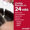 thumbnail image 2 of Sérum de primeros auxilios EMUAIDMAX concentrado 30 ml para afecciones de la piel, 2 of 8