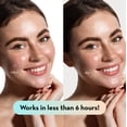 thumbnail image 4 of Parches para espinillas LE GUSHE K-BEAUTY para rostro (132 puntos), 4 of 8