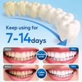 thumbnail image 4 of Fairywill LED Teeth Whitening Kit for Sensitive Teeth - 35% Carbamide Peroxide (6 x 3ml), Fast 10-Minute Daily At-Home Treatments (24 Uses) - Removes Coffee, Tea, Wine & Tobacco Stains, 4 of 12