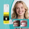 thumbnail image 4 of Mousse blanqueadora de dientes con lisosomas biológicos elimina manchas, 60 ml. Cuidado dental., 4 of 9