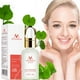 thumbnail image 2 of Esencias para el cuidado de la piel Acné Rostro Centella Asiática Control de aceite MeiYanQiong（10ml）(Compre 2 y ahorre 10%), 2 of 9