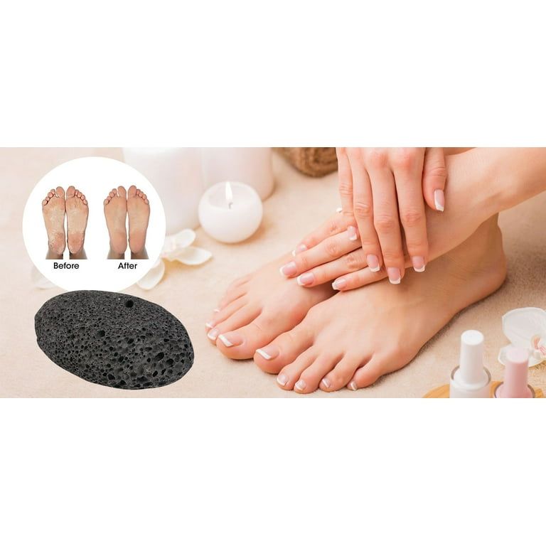  Pumice Stone - Natural Earth Lava Black - Callus/Corn Remover  for Feet Heels and Palm - Pedicure Exfoliation Tool - Dry Dead Skin  Scrubber - Health Foot Care : Beauty & Personal Care