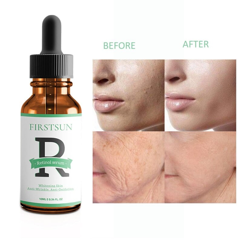Retinol 2.5% 10Ml Vitamin C Firming Repair SkinAnti Acne Anti SkinCare Face Facial