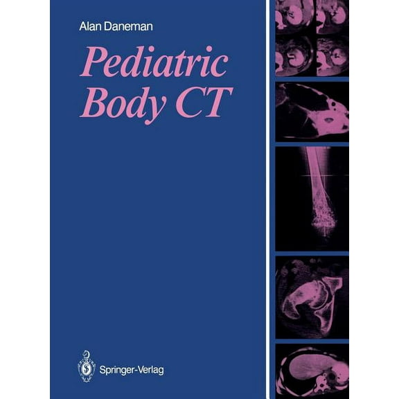 Pediatric Body CT, (Paperback)
