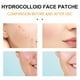 thumbnail image 4 of Parches Faciales Hidrocoloides Parche Para Eliminar El Acné Cuidado De La Piel Facial 20 Piezas / Caja Parches Faciales Hidrocoloides Parche Para Eliminar El Acné Para La Zona T ANGGREK  Otros, 4 of 8