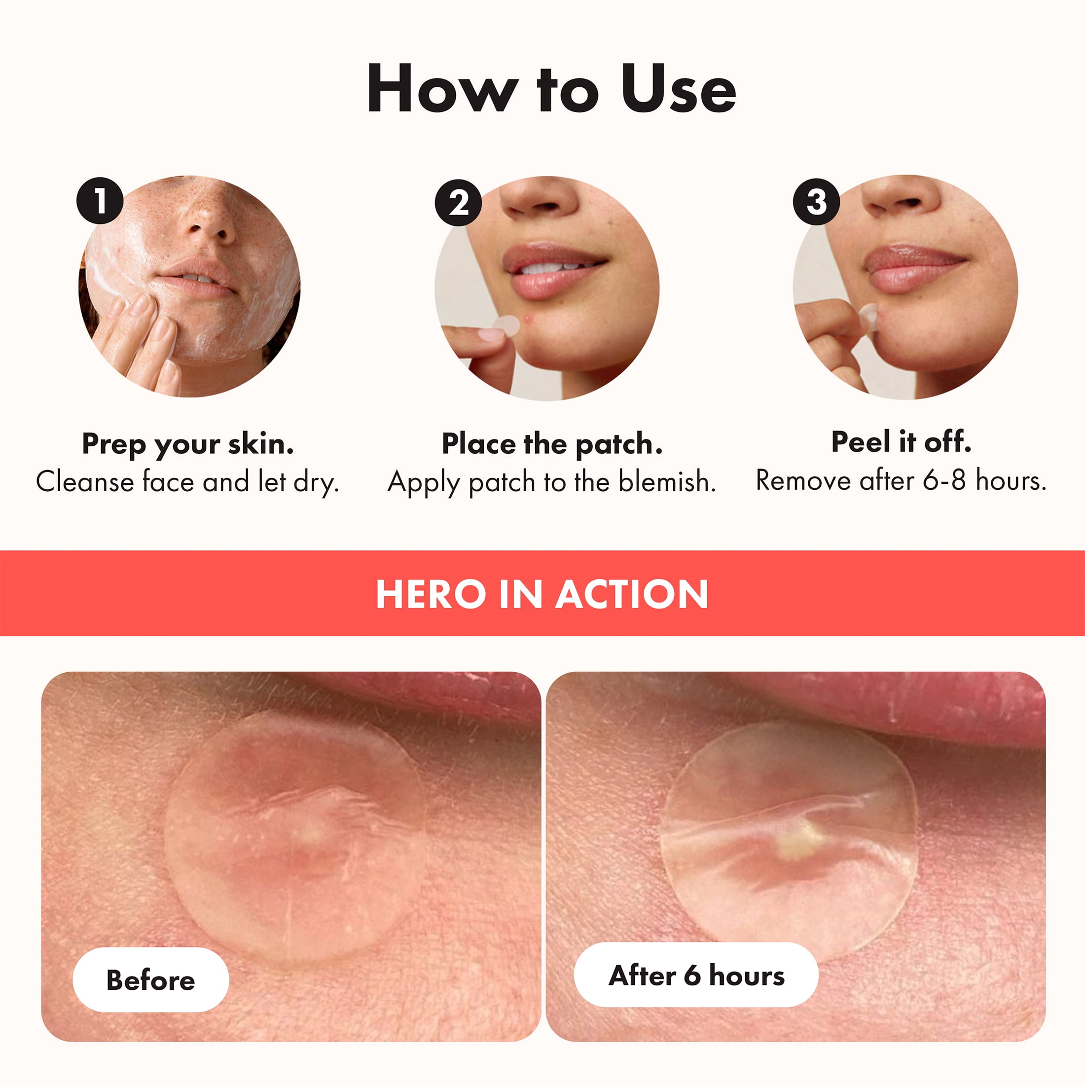 Hero Cosmetics Mighty Patch Original – Hydrocolloid Acne Patch, Overnight Acne Blemish & Zit Stickers for Sensitive Skin, 60ct