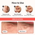 thumbnail image 4 of Hero Cosmetics Mighty Patch Original – Hydrocolloid Acne Patch, Overnight Acne Blemish & Zit Stickers for Sensitive Skin, 60ct, 4 of 6