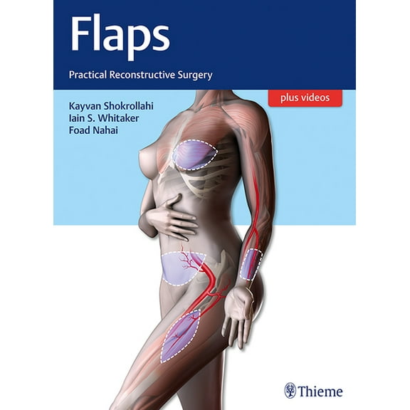 Flaps: Practical Reconstructive Surgery (Hardcover)