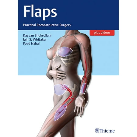 UPC: 9781604067156 | Flaps: Practical Reconstructive Surgery (Hardcover)