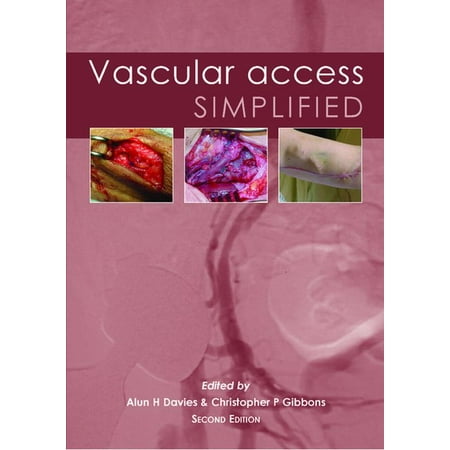 UPC: 9781903378526 | Vascular Access Simplified; Second Edition (Edition 2) (Paperback)