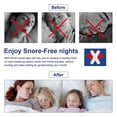 thumbnail image 3 of Anti Snore Devices Mouth Correction Stickers Snore Stopper Breathing Improving Anti Snore Strips, 3 of 4