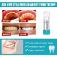 thumbnail image 2 of Mall Eelhoe - 2pack Whitening Toothpaste Foam,teeth Whitening Toothpaste Baking Soda Toothpaste, Intensive Stain Removal Toothpaste For Teeth Cleansing Sta, 2 of 5