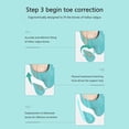 thumbnail image 2 of Separador de dedos Cuidado de los pies Hallux Valgus Ortesis Corrector de pulgar (M derecho) Likrtyny Cuidado Belleza, 2 of 7