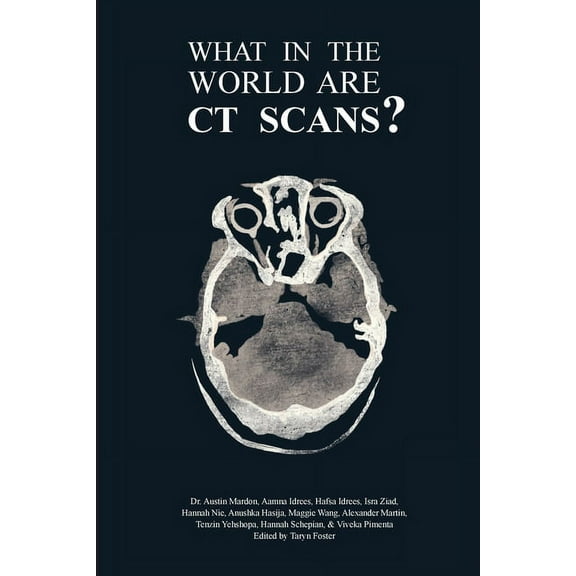 What in the World are CT Scans?, (Paperback)