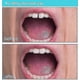 thumbnail image 3 of 2pcs Temporary Tooth Repair Kit For Filling The Missing Broken Tooth And Gaps-moldable Fake Teeth., 3 of 5