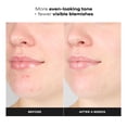 thumbnail image 2 of Tónico gel exfoliante Skin Perfecting 1% BHA de Paula's Choice, 2 of 9