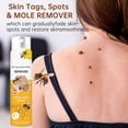thumbnail image 4 of Clearance Sale! Bee Skin Wart Care Spray Smoothing Skin Care Spray 20ml (Buy 2 get 1 free), 4 of 9