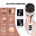 thumbnail image 3 of Electric Foot Remover with Vacuum,Professional Pedicure Tools Kit Foot File Scraper,Waterproof Remover Kit, 3 of 5