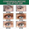 thumbnail image 3 of Eye Drops Relieves Eyes Discomfort Blurred Vision Dry Eyes Itchy Clean Relax Massage Swelling Sore Eye Care, 3 of 4