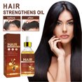 thumbnail image 3 of Castor Hair Growth Oil, Hair Regrowth Oil Thickening 3pcs 30ml  For Daily Use, 3 of 8