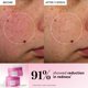 thumbnail image 4 of Pads tónico Glow Recipe PDRN+ Repair + Soothe, 60 piezas, 4 of 9