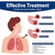 thumbnail image 3 of Dispositivo de ejercicio pulmonar, dispositivo de ejercicio de respiración para los pulmones, dispositivo de expansión pulmonar y alivio de moco, ejercicio de pulmones más fuertes: respire más fácilm, 3 of 5