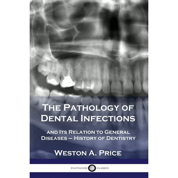 The Pathology of Dental Infections (Paperback)