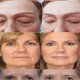 thumbnail image 5 of Suero de extracto de caracol, esencia facial, antiarrugas, ácido hialurónico, antienvejecimiento, colágeno, blanqueador, hidratante, cuidado facial, envío gratuito, 5 of 5