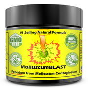 Molluscum Contagiosum Treatment Cream LARGE 60 ml Kids Adults 100% SAFE &NATURAL