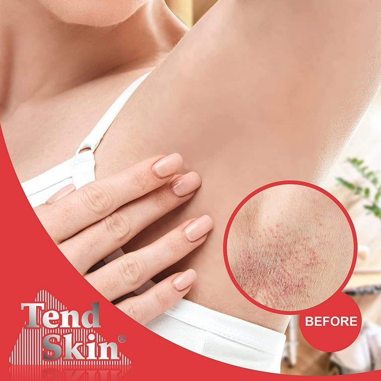 Tend Skin Solution 118 mL - CTC Health