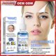thumbnail image 3 of Aceite facial antiarrugas Yashi 30ml suero facial esencia Extracto puro de plantas, 3 of 5