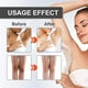 thumbnail image 3 of Snow Whitener, Dark Spot Corrector Cream, Intimate Area Skin Lightening, Dark Spot Remover for Body, Inner Thigh Lightening Cream, Armpits, Neck, Knees, Elbows, Bikini, Underarm Whitening, 3 of 5