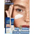 thumbnail image 2 of Crema blanqueadora antipecas, ilumina el tono de la piel, elimina las pecas, aclara las manchas, ilumina el Chloasma, hidrata el cuidado de la piel facial, 2 of 5