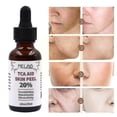 thumbnail image 2 of Suero antiarrugas para la piel con ácido tricloroacético al 20 % Tca D2t1 de 30 ml para el cuidado facial, 2 of 3