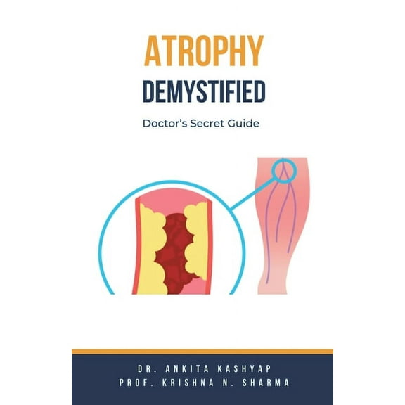 Atrophy Demystified: Doctor's Secret Guide, (Paperback)