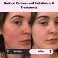 thumbnail image 2 of Mascarilla facial Glorio Calm de arcilla, 8 unidades, para piel sensible, 2 of 6
