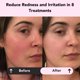 thumbnail image 2 of Mascarilla facial Glorio Calm de arcilla, 8 unidades, para piel sensible, 2 of 6