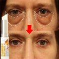 thumbnail image 1 of Crema blanqueadora de pecas, puntos negros, melasma, antimanchas, aclara la pigmentación, hidratante, productos coreanos para el cuidado de la piel, 1 of 6