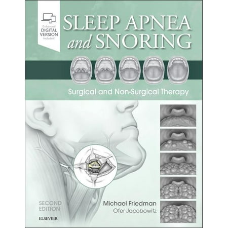- Sleep Apnea and Snoring : Surgical and Non-Surgical Therapy